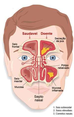 a) Cavidade nasal É a entrada das vias respiratórias, sendo dividida pelo septo nasal em cavidade nasal direita e esquerda.