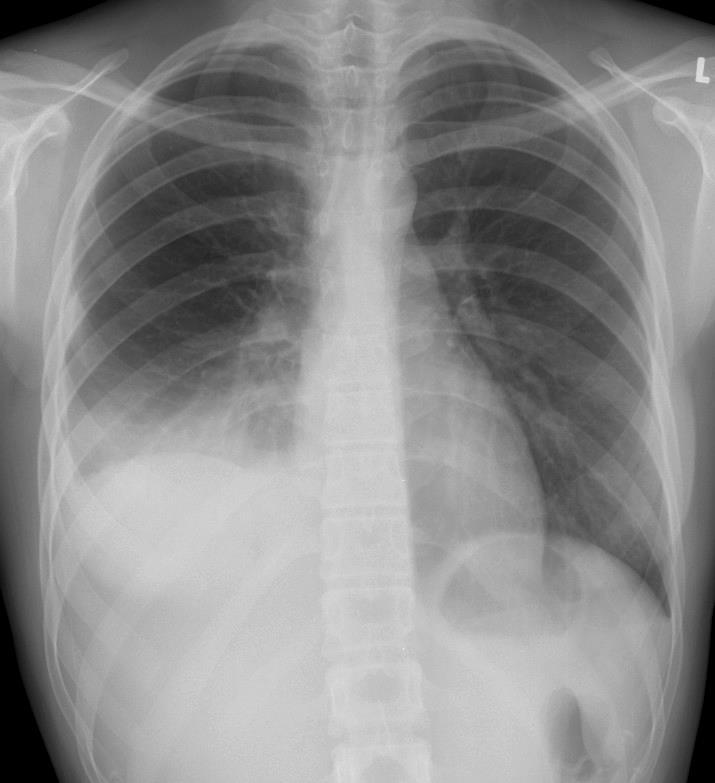 Radiografias do torax