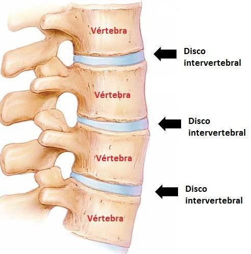 d) Fibrocartilagem: Altamente comprimida e com grande força tênsil.