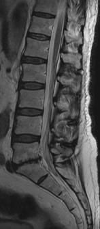 Estruturas anatômicas da coluna vertebral Ligamentos Lig. Longitudinal anterior Lig. Interespinhoso Lig. Supraespinhoso Lig.
