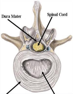 Discos intervertebrais Discos