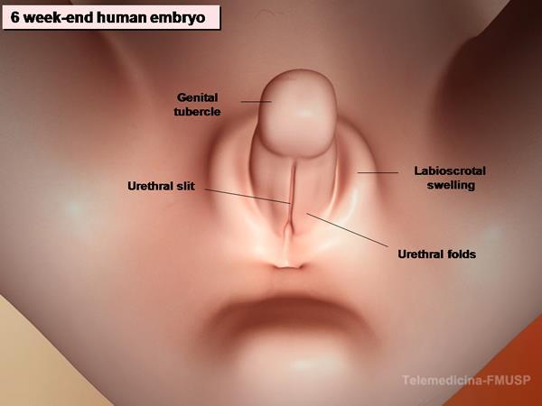 A genitália ambígua é uma anomalia de nascença que consiste no fato dos genitais exteriores não terem a aparência típica de um rapaz ou de uma menina.