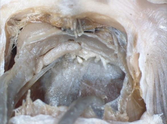 Estômago Fígado Estômago Esôfago Órgão acessório inflado Intestino Abertura lateral do órgão acessório A B C Figura 5. Cavidade abdominal de Loricariichthys acutus (A; INPA 9783, 105.5 mm CP), L.