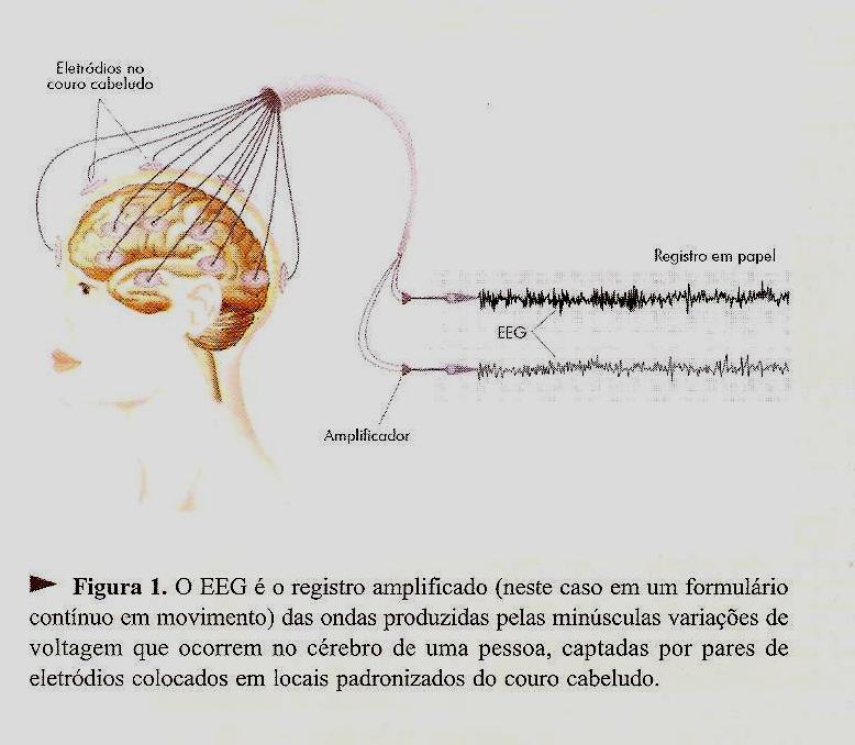 EEG