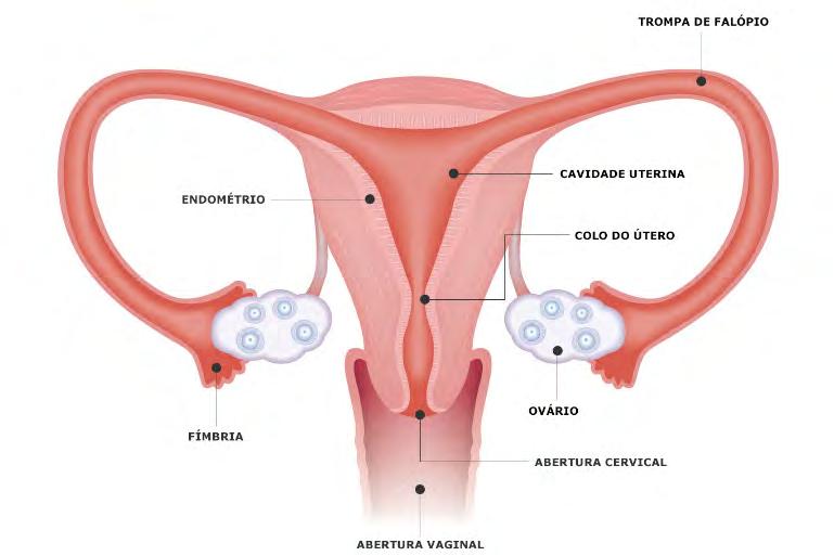 2. Fator Uterino Existem irregularidades na cavidade uterina que podem dificultar a fixação do embrião na parede uterina.