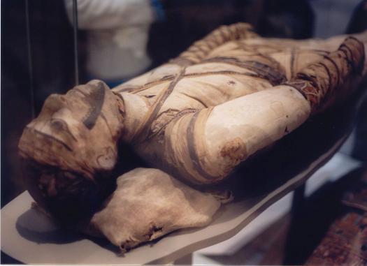 TB faz parte da história da humanidade Evidências irrefutáveis em múmias da pré-história (4.000 a.