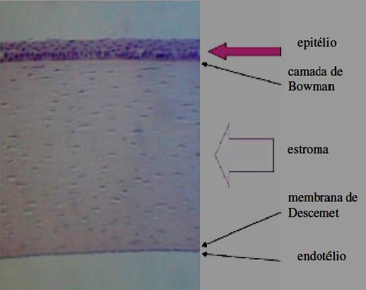 LITERATURA 6 A espessura da córnea humana é de aproximadamente 540µm (17) e é composta principalmente do estroma que situa-se entre a camada de Bowman anteriormente e a membrana de Descemet