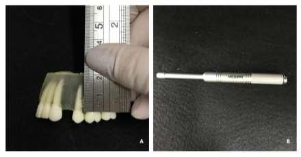 52 Figura 11 (A) Demarcação do ponto de inserção do mini-implante, segundo a altura, com o auxílio de uma régua milimetrada; (B) Chave apropriada utilizada para a inserção dos mini-implantes.