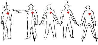 Para que o choque ocorra, deve haver uma diferença de potencial entre dois pontos distintos do corpo humano, ou seja, quanto maior for a diferença de potencial, maior será a corrente