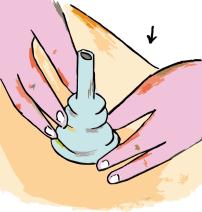 Assegure-se que a fralda está bem aplicada com a parte absorvente em contacto com a pele.