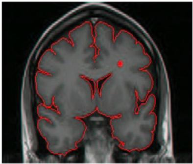 Tais imagens oferecem não apenas uma forma de visualização de órgãos, tecidos, ossos e outras estruturas do corpo de um paciente, mas, também, meios para monitorar efeitos de tratamentos e subsídios