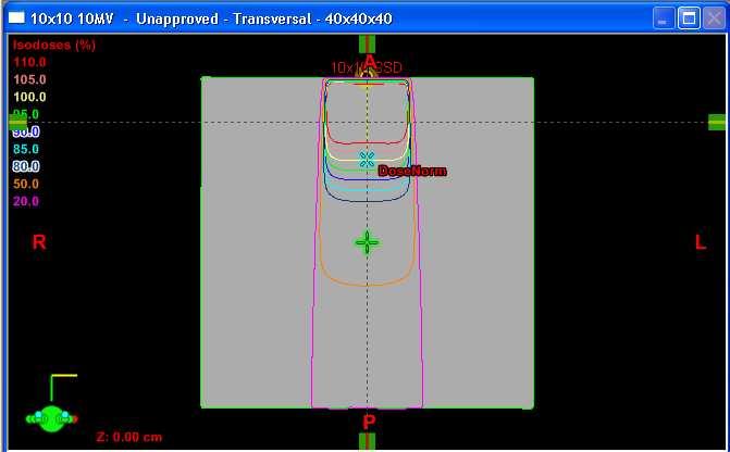 a) b) Figura 10. a) Plano do caso teste nº 1, para energia de 10 MV.