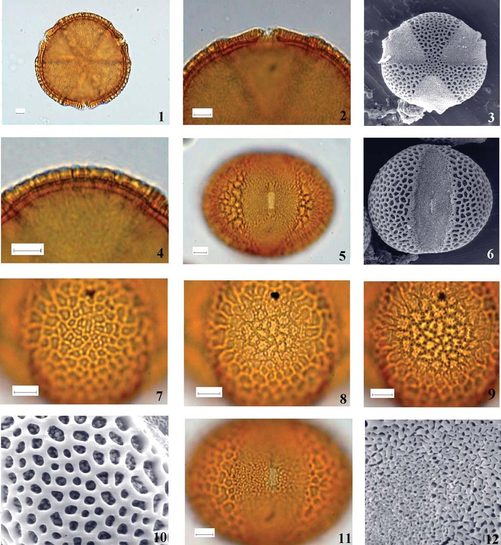 Revista Brasil. Bot., V.26, n.3, p.355-359, jul.-set. 2003 357 Figuras 1-12. Fotomicrografias e eletromicrografias dos grãos de pólen de Caesalpinia echinata. 1. Contorno em vista polar. 2. Corte óptico na região da abertura, em vista polar.