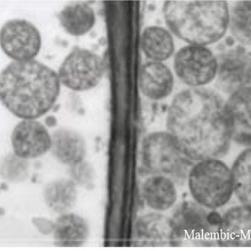O fitoplasma da FD é uma bactéria sem parede celular que vive no floema da videira.