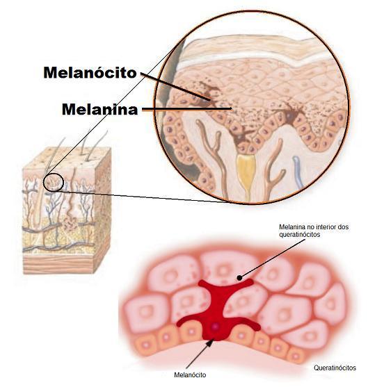 Células da epiderme especializadas na produção de melanina, um pigmento de cor marrom, originado a partir do aminoácido tirosina, que recobre a pele e os pelos, protegendo o organismo da