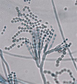 expansum; b) imagem de P. expansum por microscópio óptico; c) colônia típica de P.