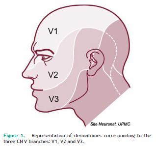 3 Nevralgia do Trigémio 3.1 Anatomia O trigémio é o principal nervo sensitivo da cabeça e da face, constituindo o V par craniano.