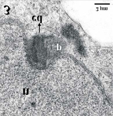 mostrando a membrana acrossômica (ma) associada à porção anterior do núcleo (n); 3, Secção