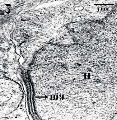 centríolo distal com a membrana plasmática, a presença de microtúbulos no axonema em formação na