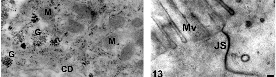 Micrografia eletrônica do intestino médio de Brontocoris tabidus (Heteroptera: