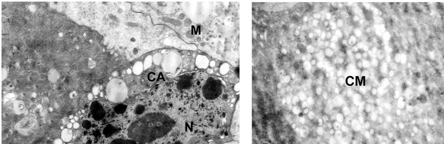 Micrografia eletrônica do intestino médio de Brontocoris tabidus (Heteroptera: Pentatomidae). Fig. 16.