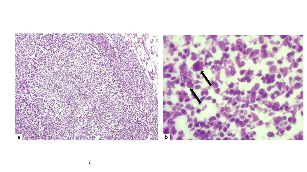 c- No destaque as células neoplásicas de formato variado, típicas de sarcoma histiocítico. Aumento de 400x. Fonte: Laboratório de Patologia Animal UFU.