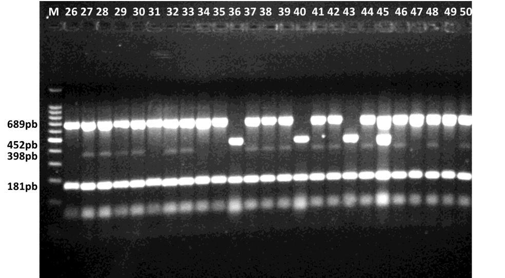 A B Figura 9 Análise eletroforética dos produtos de RT-PCR multiplex,