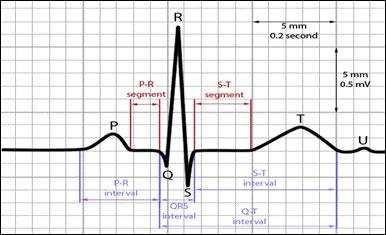 5) Reinício da diástole atrial e ventricular. A relação entre o eletrocardiograma e o ciclo cardíaco O eletrocardiograma, demonstrado esquematicamente na figura acima, mostra as ondas P, Q, R, S e T,.