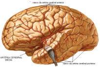 Componente liquórico: constituído pelo líquido cefalorraquidiano (LCR) das cavidades ventriculares e do espaço subaracnoide (líquido cerebroespinhal).