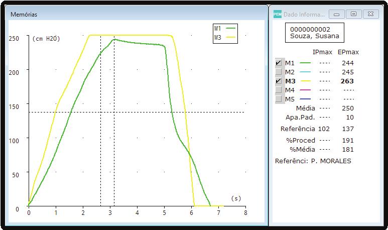 Manual do Software SIBELMED W20s 135 É útil para a comparação da forma das manobras e para observar a diferença existente entre os instantes em que se deram os valores de pressão máxima. Anexo 2.