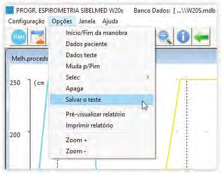 Manual do Software SIBELMED W20s 138 Anexo 2. Exame de pressões máximas B.