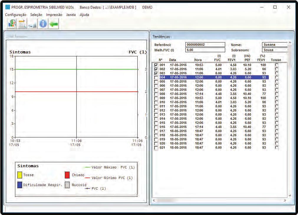 Manual do Software SIBELMED W20s 42 Clicando no botão de TENDÊNCIAS aparece a seguinte tela: Nesta janela todas as provas de FVC do paciente são visualizadas, para realizar um relatório da tendência