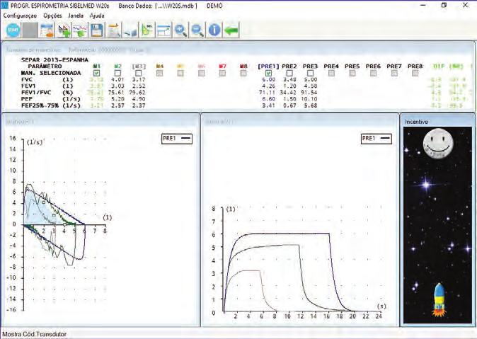 Manual do Software SIBELMED W20s 73 O procedimento para realizar a prova de Espirometria Pós-broncodilatadora é o seguinte: 1 Realize uma prova de «FVC», «VC» o «MVV», segundo o indicado nos