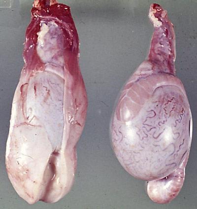 22 protetora se instala completamente por volta do período correspondente ao terceiro abortamento.