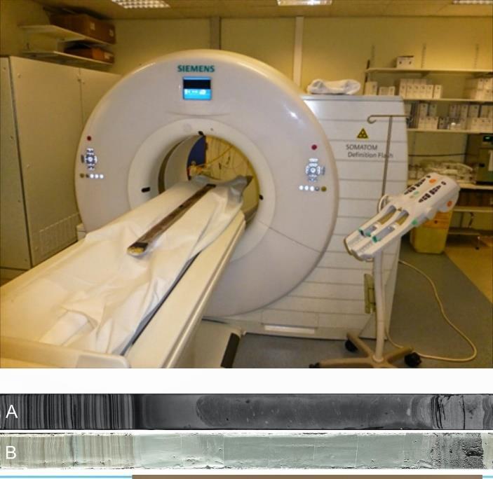 11 Figura 2.3. Tomografia computadorizada de um testemunho no Hospital Universitário de Ghent (26).