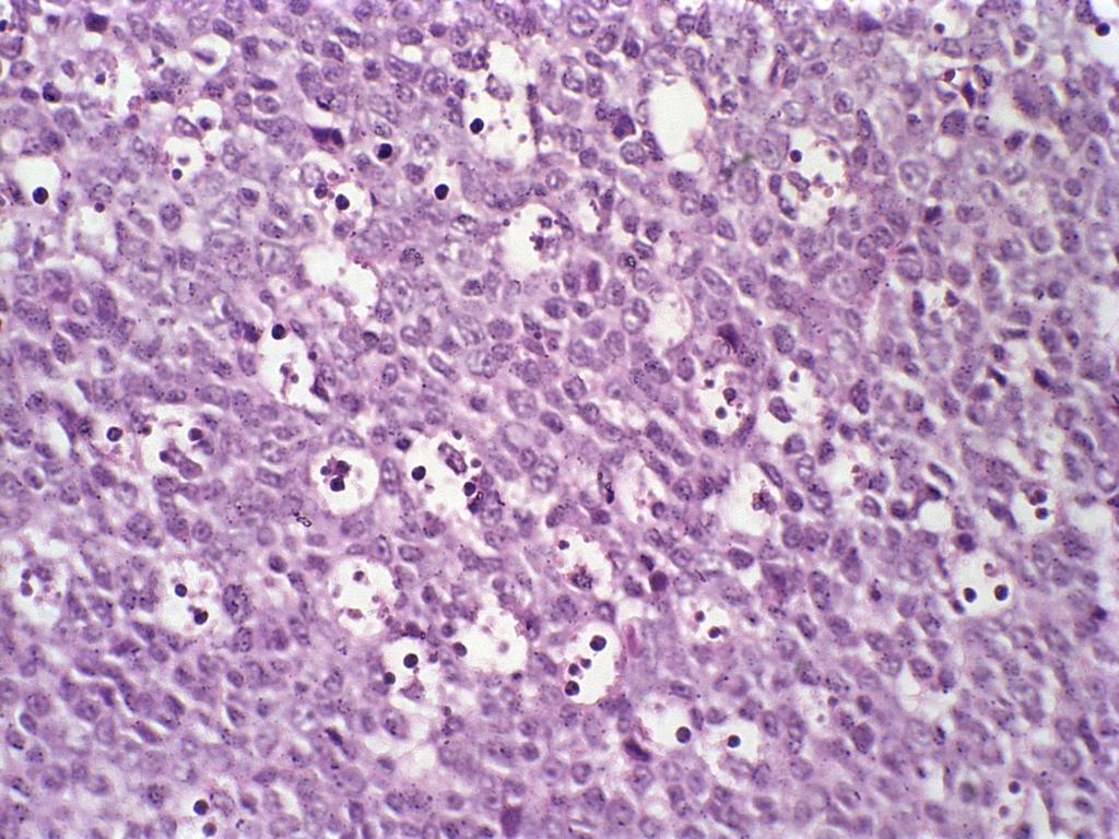 44 FIGURA 10- Fotomicrografia de baço de rato, após tratamento com 600 mg/kg mostrando presença de células apoptóticas (aumento 20