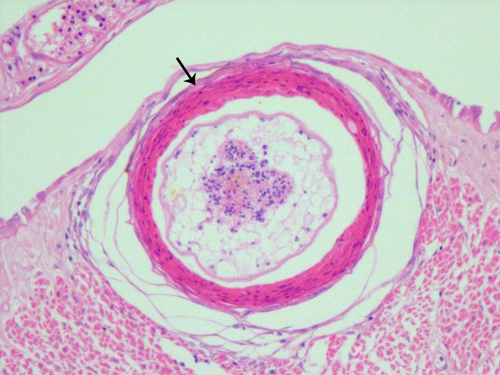 Histopatologia do intestino de Pseudoplatystoma fasciatum... 155 RESULTADOS E DISCUSSÃO Todos os intestinos analisados de P. fasciatum estavam parasitados por cestodas e/ou nematodas.