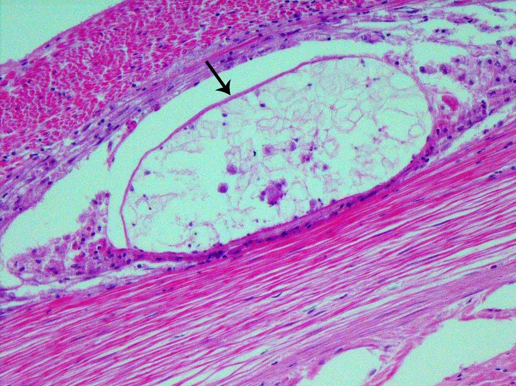 156 CAMPOS et al. Figura 2. Encapsulamento recente (seta) de parasito na camada muscular do intestino de P. fasciatum. 400X.