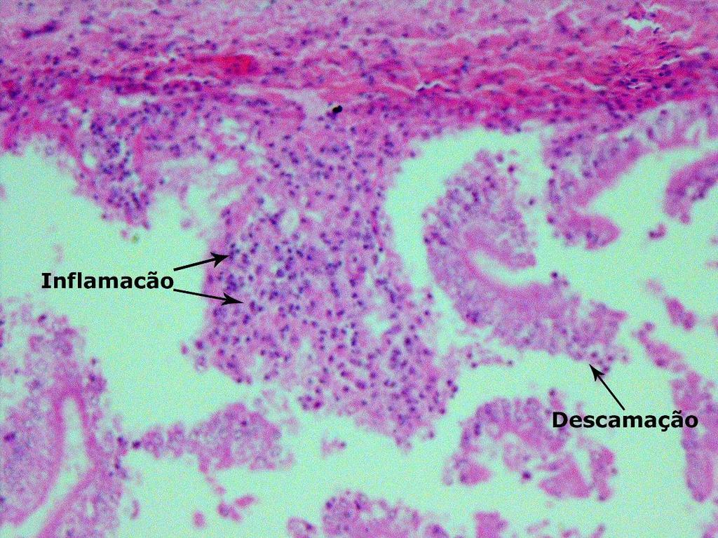 Descamação severa da mucosa (Figura 3) ocorreu em poucos casos, porém na maioria foi observada pelo menos descamação discreta da mucosa, sempre na lâmina própria, além de um espessamento da membrana