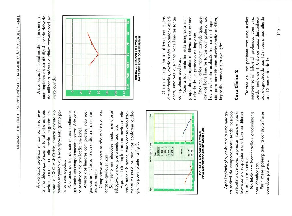 ALGUMAS DFCULDADES NO PROGNÓSTCO DA REAB LTAÇÃO NA SURDEZ NFANTL A avaliação protética em campo livre, revela uma diferença funcional tonal entre os dois ouvidos, em que o direito revela um ganho