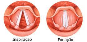 Laringe - Epiglote bloqueio da