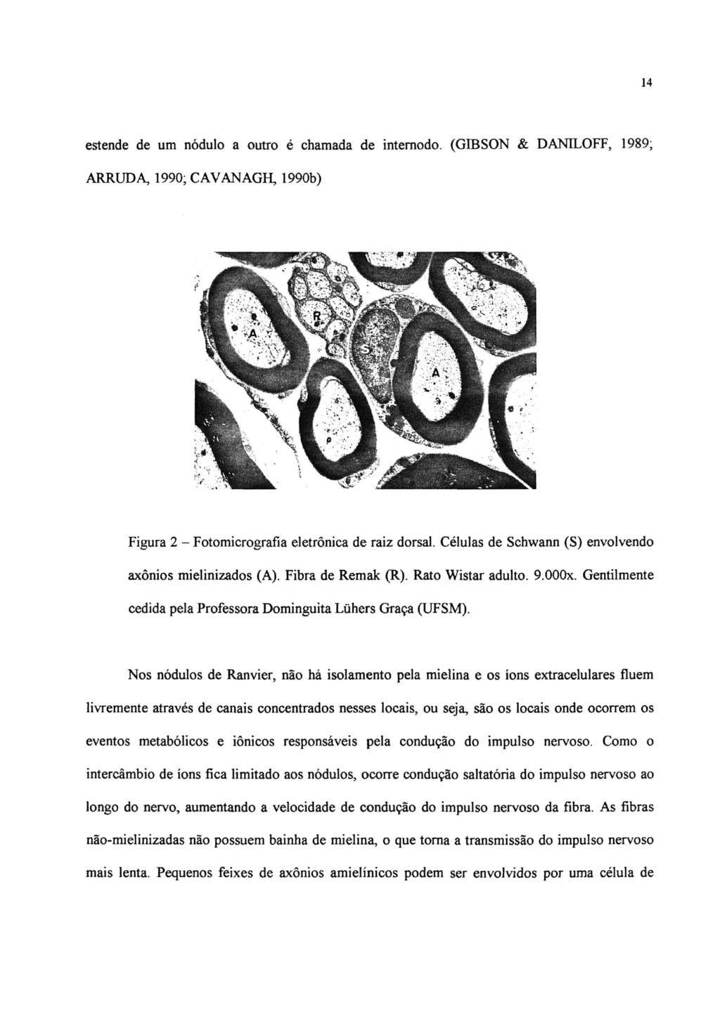 14 estende de um nódulo a outro é chamada de intemodo. (GffiSON & DANll.,OFF, 1989; ARRUDA, 1990; CAVANAGH, 1990b) Figura 2 - Fotomicrografia eletrônica de raiz dorsal.