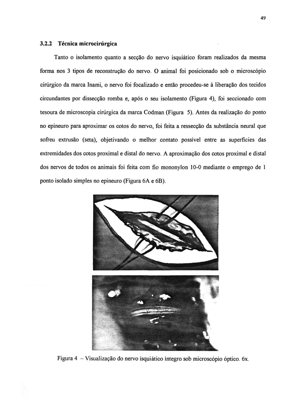 49 3.2.2 Técnica microcirúrgica Tanto o isolamento quanto a secção do nervo isquiático foram realizados da mesma forma nos 3 tipos de reconstrução do nervo.