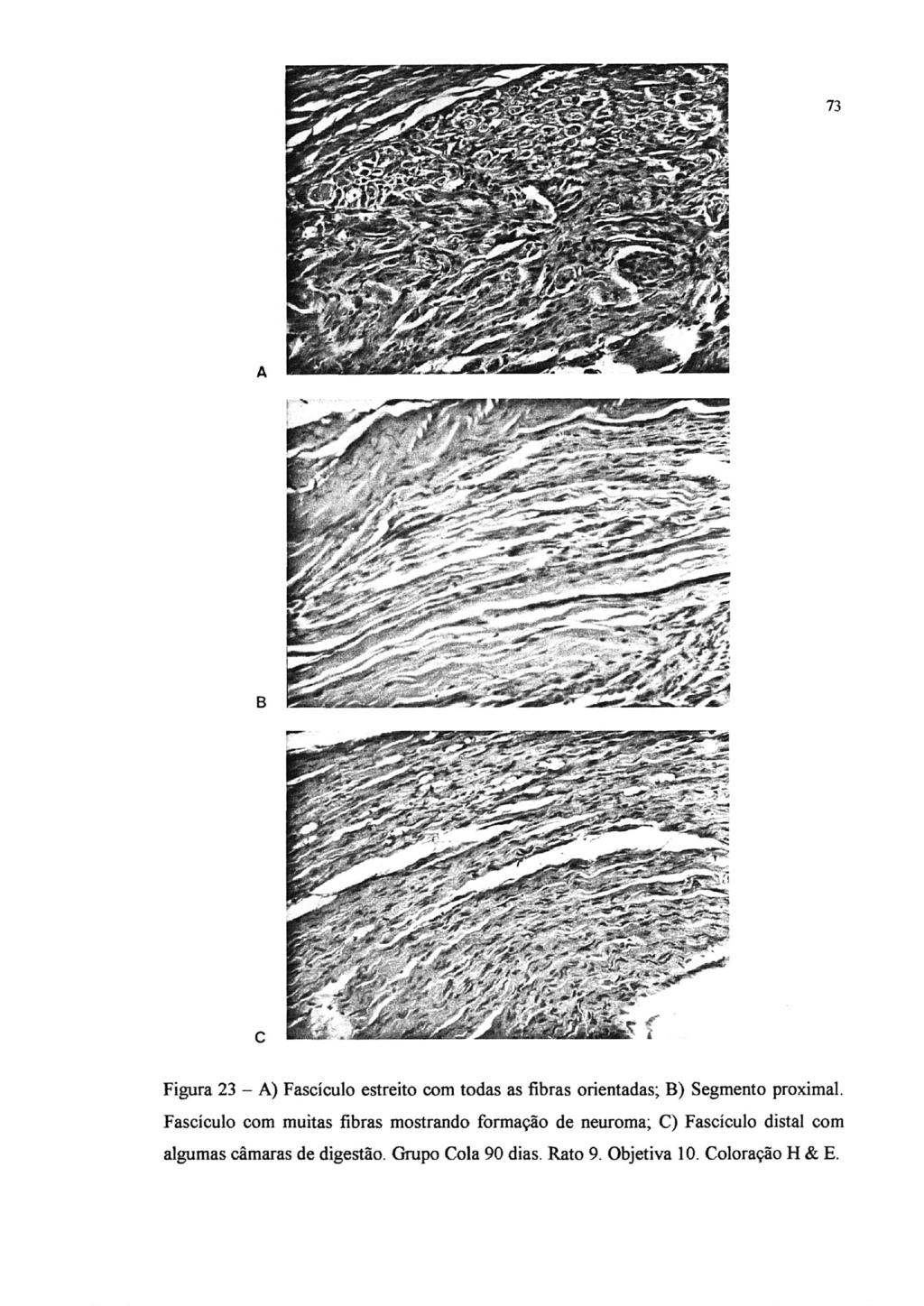 73 A B c Figura 23 - A) Fascículo estreito com todas as fibras orientadas; B) Segmento proximal.