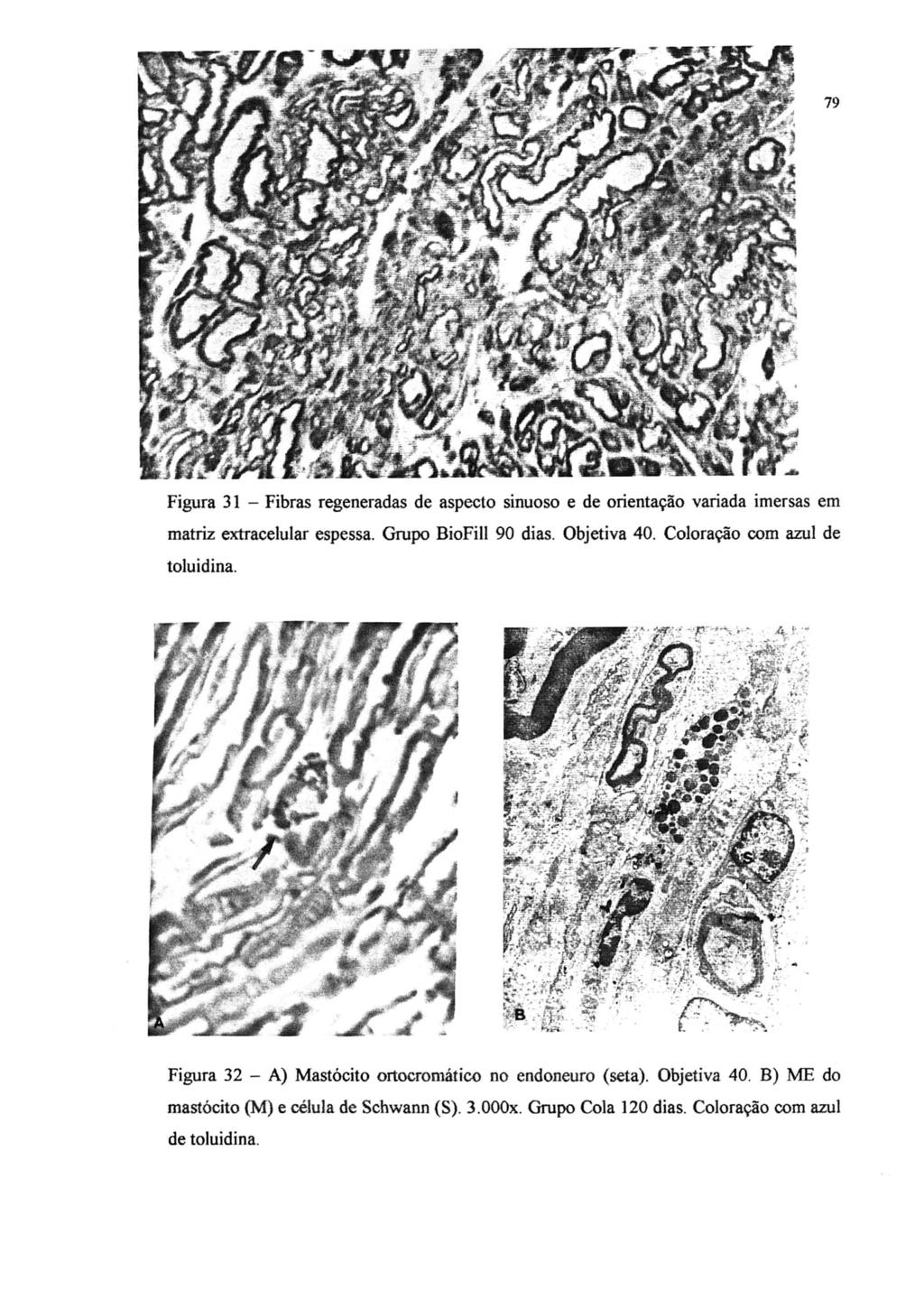 79 Figura 31 - Fibras regeneradas de aspecto sinuoso e de orientação variada imersas em matriz extracelular espessa. Grupo BioFill 90 dias. Objetiva 40.