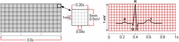 15 Figura 2 - Medidas e grandezas na inscrição de ECG. Fontes: (ECG1, 2008), (KLABUNDE, 2008).