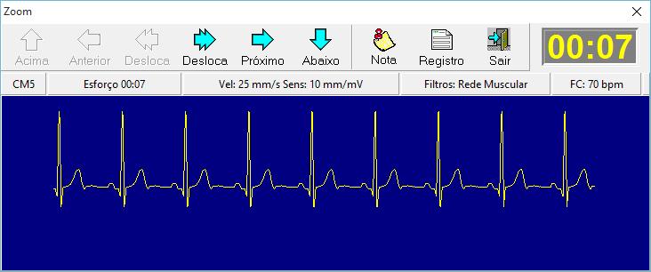 Ampliar para uma melhor visualização um trecho selecionado através das setas de navegação. Ao clicar no ícone ZOOM, a caixa de ampliação do traçado, abaixo, irá abrir.