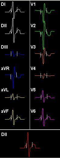 Médias Esta tela permite a visualização de todas as médias, possibilitando ao médico se concentrar nas derivações que lhe interessam e fazer o acompanhamento das demais.