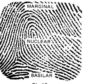 com pouca variação de direção. As linhas que compõem o sistema nuclear assumem formas variadas e, por isso, são mais empregadas para as classificações datiloscópicas.