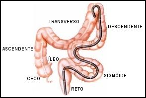 Colonoscopia é um exame endoscópico que permite a visualização do interior de todo o cólon (intestino grosso).